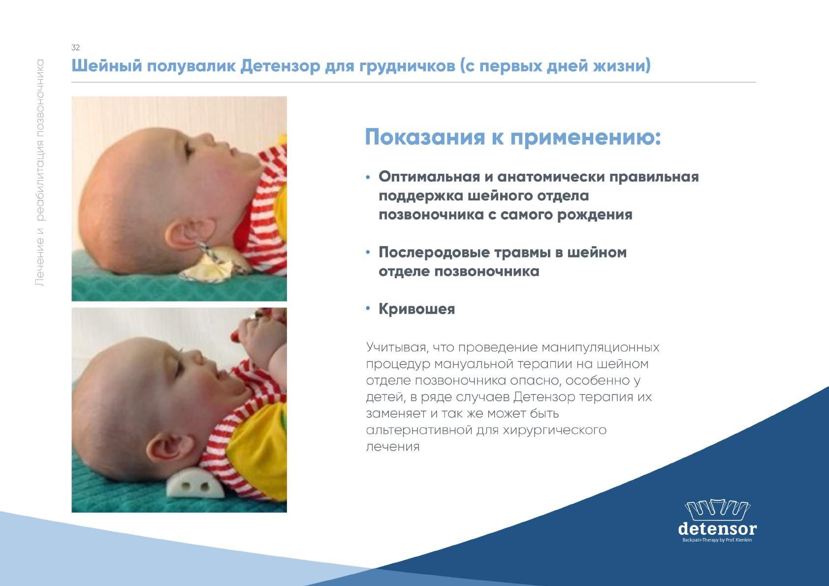 Травма шейного отдела позвоночника у новорожденных
